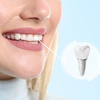 A photo highlighting a woman’s completed dental implant