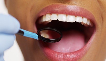 Closeup of smile during dental exam