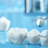 Dental bridge and implant with dental mirror on reflective light blue surface