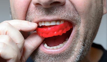 close up of man with short beard inserting red mouthguard 