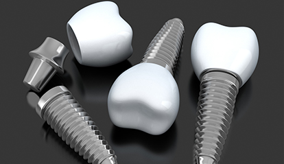 Three animated implant supported dental crowns