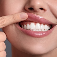 A woman looking at her gums