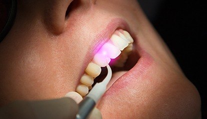 Patient receiving laser dentistry