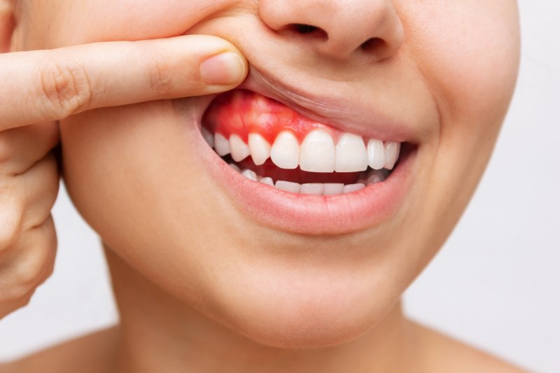 A woman looking at her gum disease