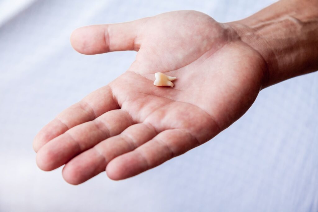Entire tooth in palm of someone's hand