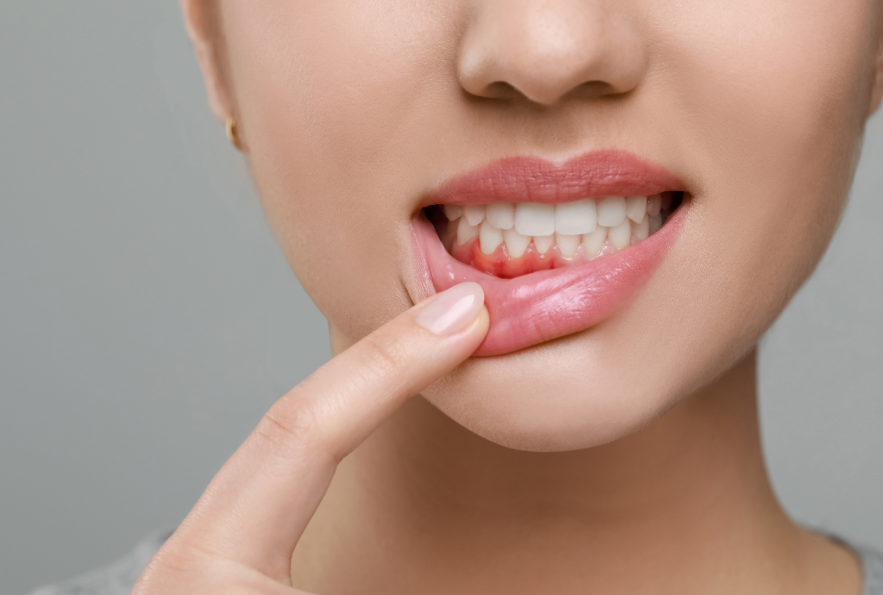 Close up of woman's mouth showing gums